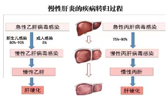 【健康科普】世界肝炎日——堅持早預(yù)防,加強檢測發(fā)現(xiàn),規(guī)范抗病毒治療
